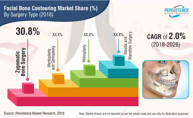 facial-bone-contouring-market.jpg